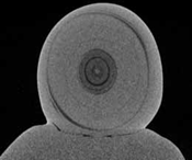 Tokki perla radiografie